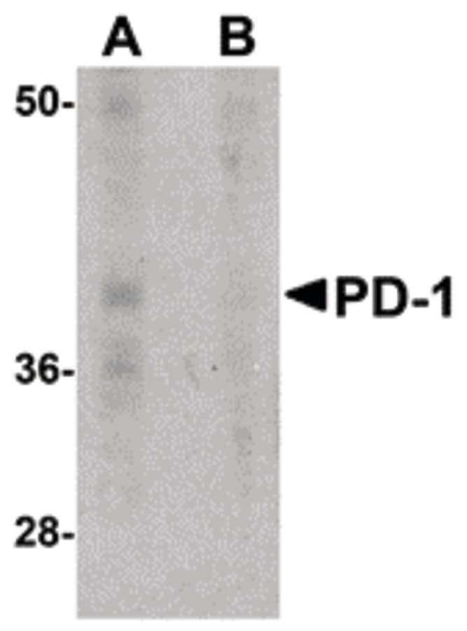PDCD1 / CD279 / PD-1 Antibody (clone 7A11B1)