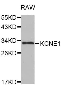 Polyclonal Rabbit anti-Human KCNE1 / MinK Antibody (IHC, WB)