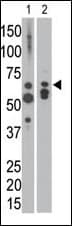 Polyclonal Rabbit anti-Human MTM1 / Myotubularin Antibody (aa566-594, WB)