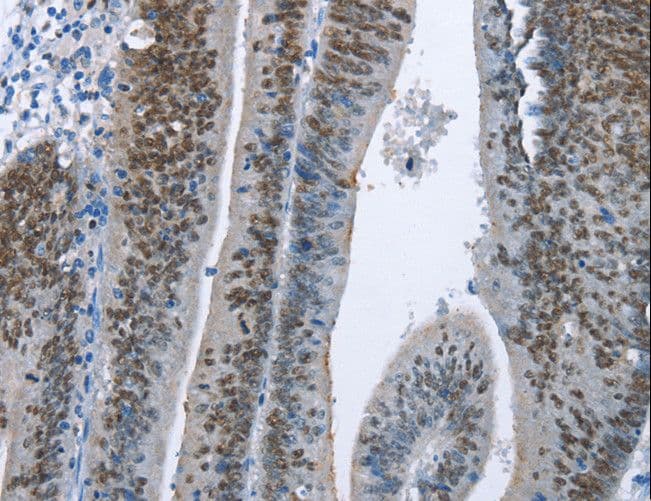 MCM6 Antibody