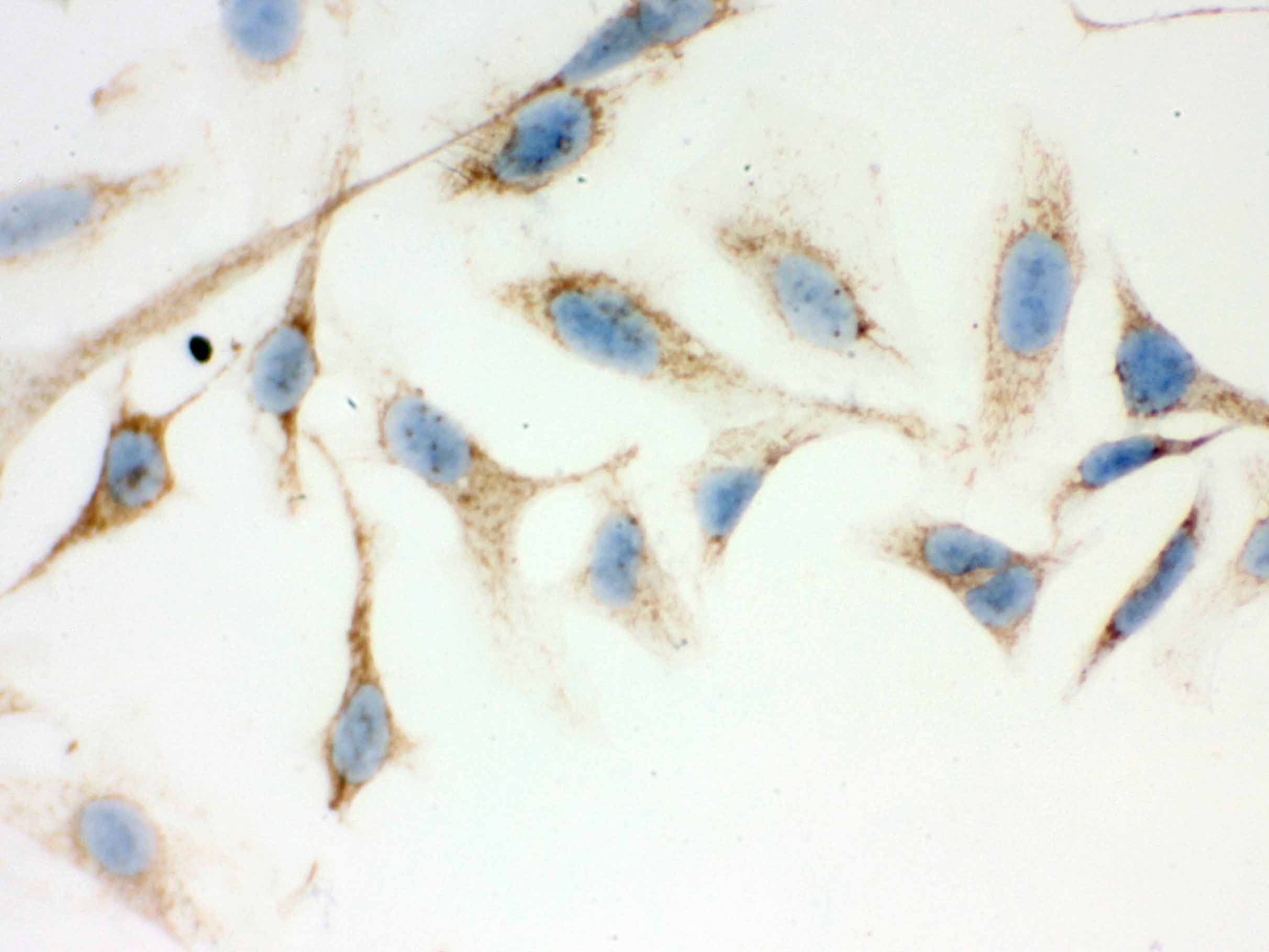 HSD17B10 / HADH2 Antibody (aa48-261)