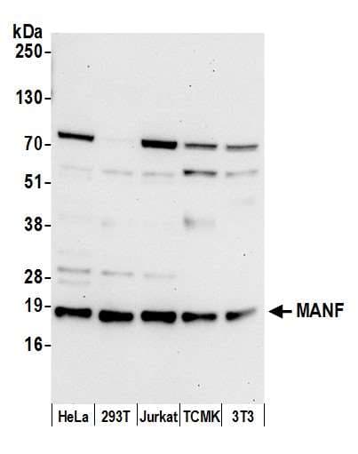 MANF / ARMET Antibody (aa132-182)
