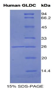 Human GLDC Protein (Recombinant His)