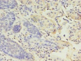 LYZ / Lysozyme Antibody (aa19-148)