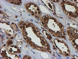 PSMB9 Antibody (aa21-219, clone OTI2G6)