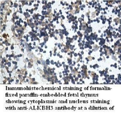 PCA1 / ALKBH3 Antibody (aa2-95)