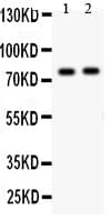 Polyclonal Rabbit anti-Human LAMP1 / CD107a Antibody (aa403-417, WB)