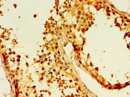 EDA2R / XEDAR Antibody (aa1-138)