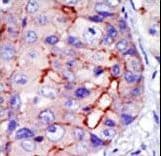 CAMK1D Antibody (aa302-333)