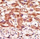 Polyclonal Rabbit anti-Human MGAT / GLYT1 Antibody (aa16-46, IHC, WB)