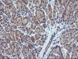 CTAG1B / NY-ESO-1 Antibody (clone OTI3H8, Carrier-free)