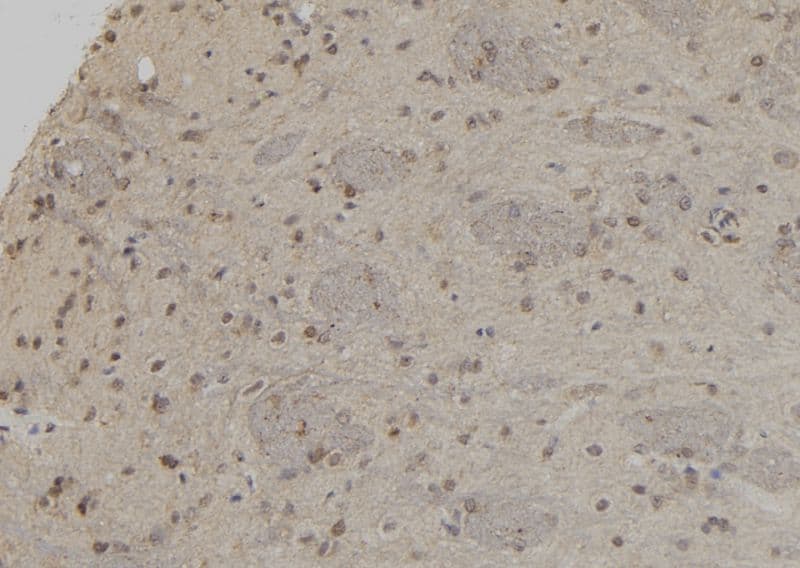 UBA3 / UBE1C Antibody