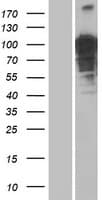 OTUD4 Protein (Over-Expression Lysate Myc-DDK (Flag))