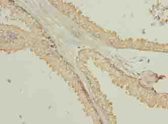 Polyclonal Rabbit anti-Human TMEM140 Antibody (IHC)