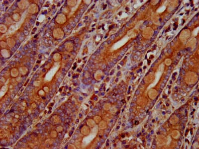 OLFM4 / Olfactomedin 4 Antibody
