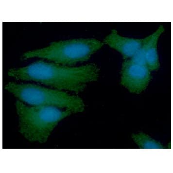 PSMD11 Antibody (clone AT2C7)