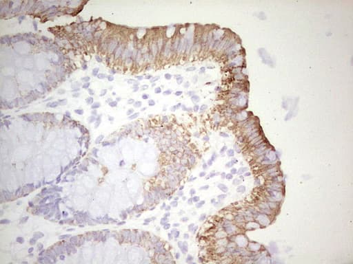 Monoclonal Mouse anti-Human ABCB1 / MDR1 / P Glycoprotein Antibody (clone OTI11D2, aa995-1280, IHC)