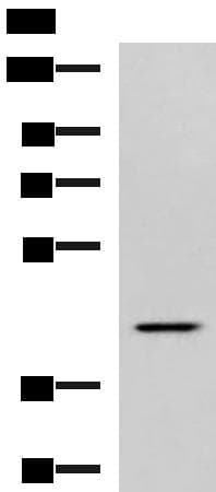 SYT2 Antibody