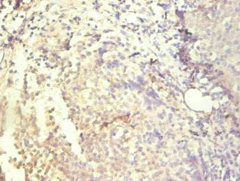 IHC-plus™ Monoclonal Mouse anti-Human IL8 / Interleukin 8 Antibody (IHC)
