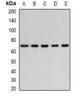 BEST1 / BEST / Bestrophin Antibody