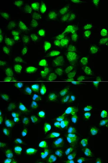 TCF4 Antibody
