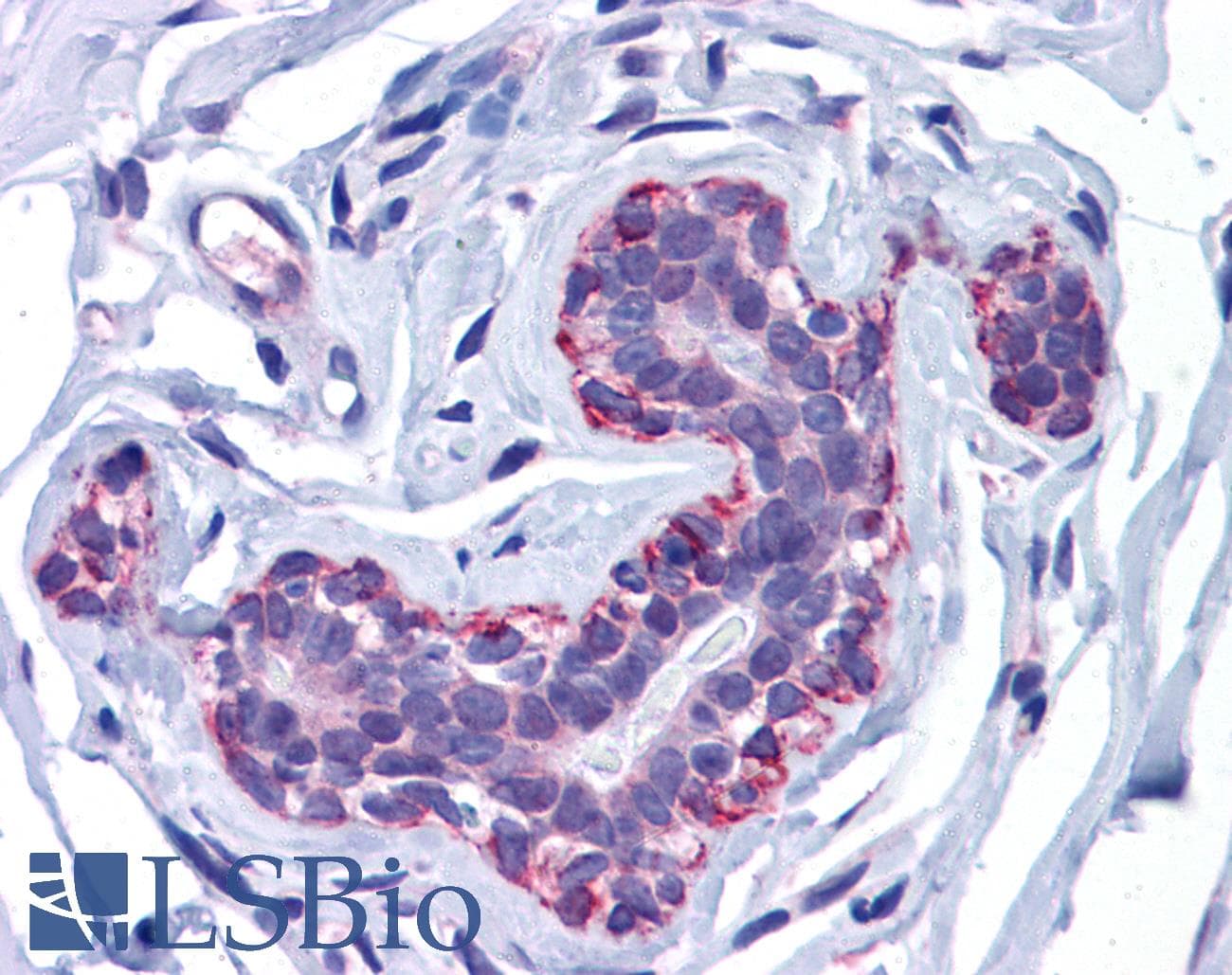 IHC-plus™ FREM2 Antibody