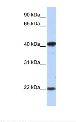 LIN7C / VELI3 Antibody (aa108-157)