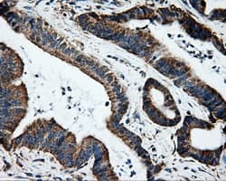 HSD17B10 / HADH2 Antibody (clone OTI10B4)