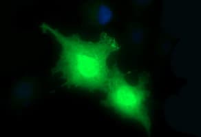 Monoclonal Mouse anti-Human PLA2G16 / HRASLS3 Antibody (clone OTI1A5, IHC, IF, WB)