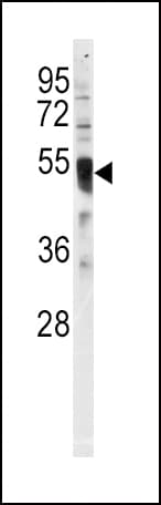 ICSBP / IRF8 Antibody (aa384-409)