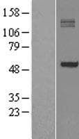 Human P4HA1 Protein (Over-Expression Lysate Myc-DDK (Flag))