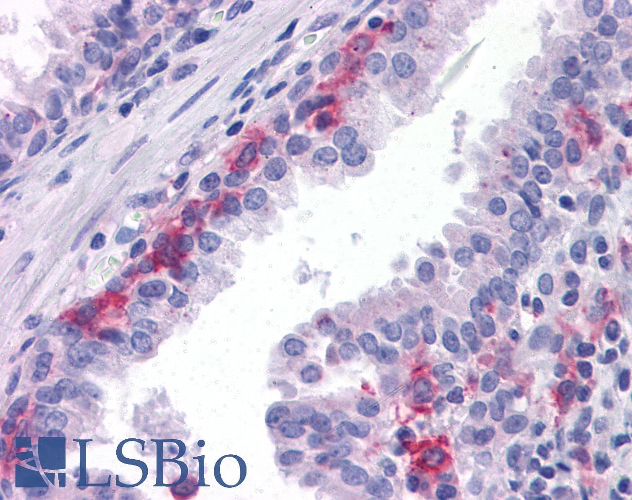 IHC-plus™ AXL Antibody (clone 7E10)