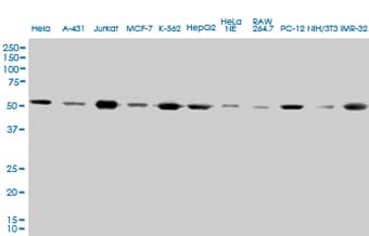 IHC-plus™ Monoclonal Mouse anti-Human TUBA4A / TUBA1 Antibody (clone 2E11, IHC, IF, WB)