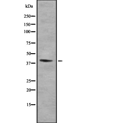 ST3GAL3 / ST3N Antibody