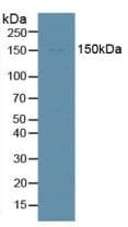 DDX58 / RIG-1 / RIG-I Antibody (aa1-211)