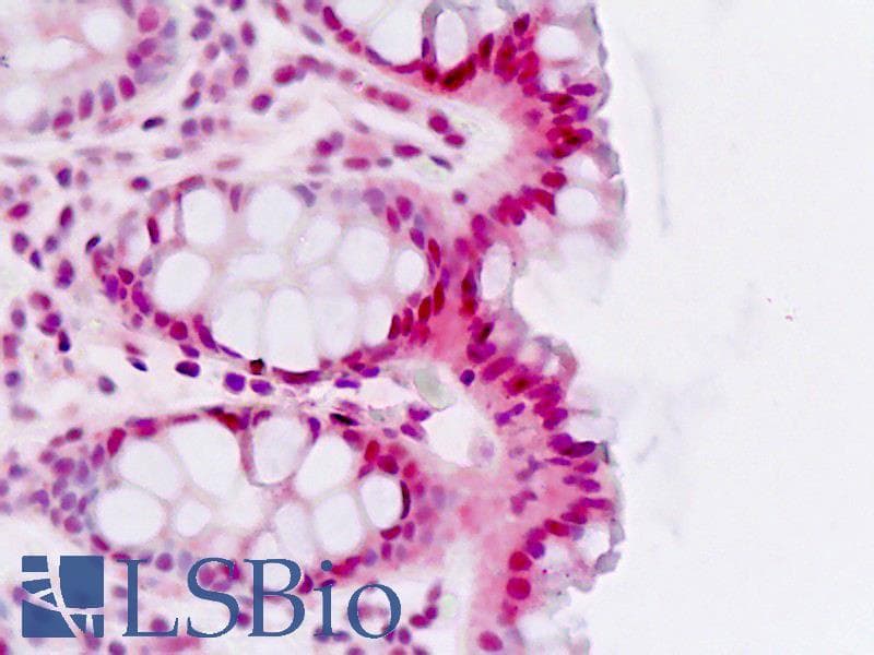 IHC-plus™ Polyclonal Rabbit anti-Human RORA / ROR Alpha Antibody (Thr216, IHC, IF, WB)