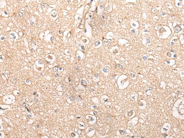 Polyclonal Rabbit anti-Human MTNR1B / MT2 Antibody (IHC)