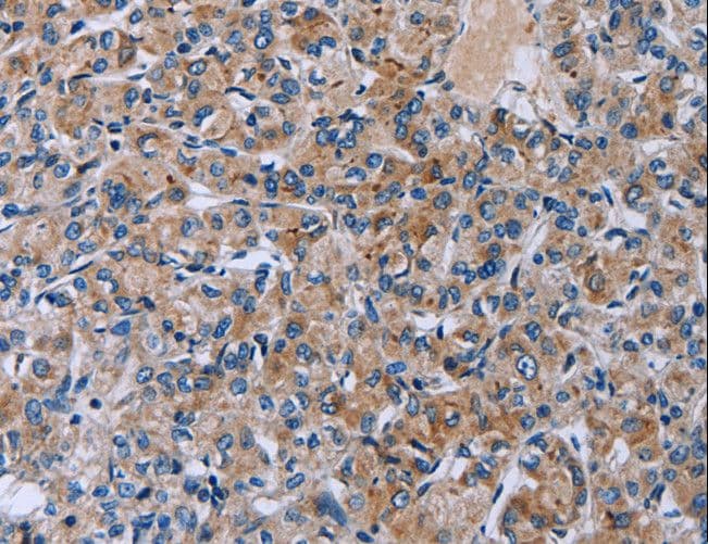 HSD3B2 Antibody