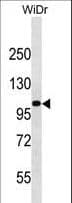 Polyclonal Rabbit anti-Human c-Kit / CD117 Antibody (aa556-585, WB)