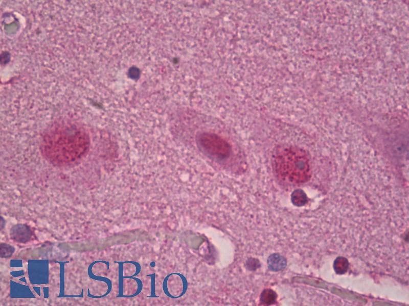 IHC-plus™ RORA / ROR Alpha Antibody (aa6-55)