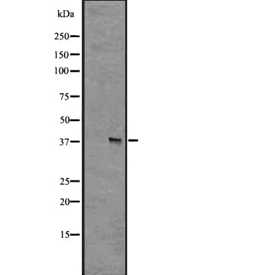 Polyclonal Rabbit anti-Human GPR55 Antibody (IHC, WB)