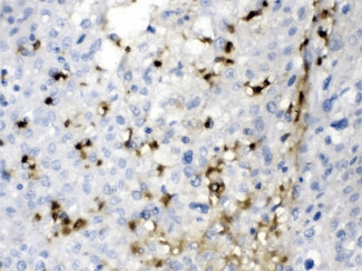 CA2 / Carbonic Anhydrase II Antibody