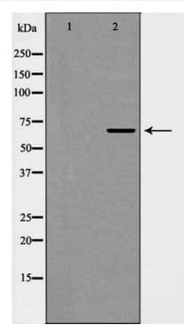 EIF4B Antibody (phospho-Ser422)