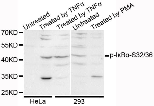 NFKBIA / IKB Alpha / IKBA Antibody (phospho-Ser32/36, AP)