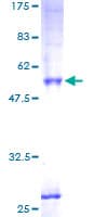 Human PPAP2C Protein (Recombinant GST)