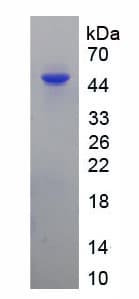 Human Alpha-1-Antichymotrypsin Protein (Recombinant His-GST)