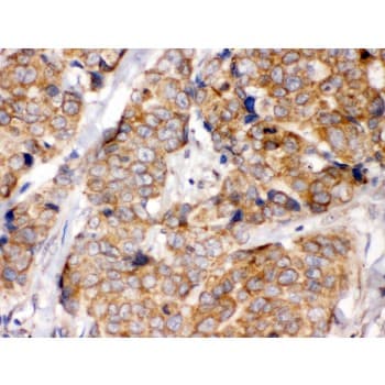 EIF4A2 Antibody (aa5-31)