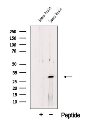 TMEM158 / RIS1 Antibody
