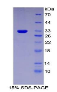 Rat IFNAR1 / IFNAR Protein (Recombinant His)