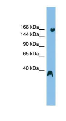 Polyclonal Rabbit anti-Human LTN1 / RNF160 Antibody (aa47-96, WB)
